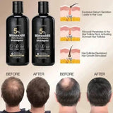 Minoxidyl Shampoo and Conitioner