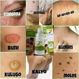 Angel Touch Kasoy Oil