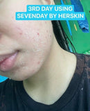 7 Days Rejuvinating Set by Her Skin