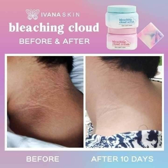 Ivana Skin Bleaching Cloud Scrub and Cream Bundle – Lucky 888 Shop