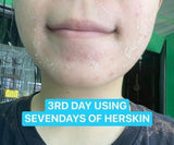 7 Days Rejuvinating Set by Her Skin