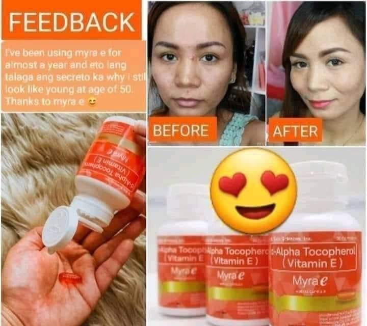 Myra E 30 Capsules 400IU – Lucky 888 Shop